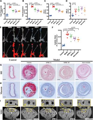 S-propargyl-cysteine promotes the stability of atherosclerotic plaque via maintaining vascular muscle contractile phenotype